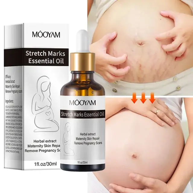 Stretch Marks Essential Oil