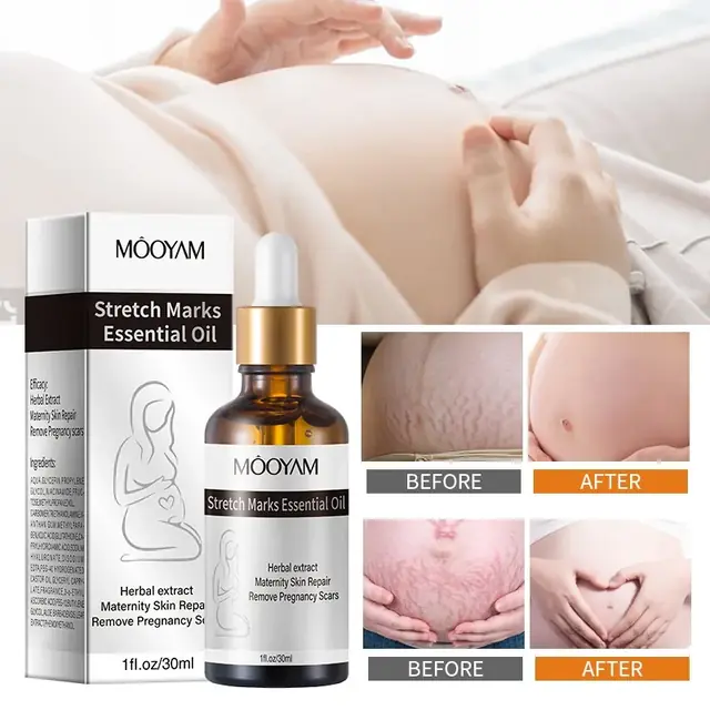 Stretch Marks Essential Oil - Image 4