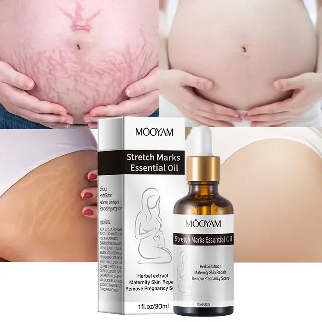 Stretch Marks Essential Oil - Image 2