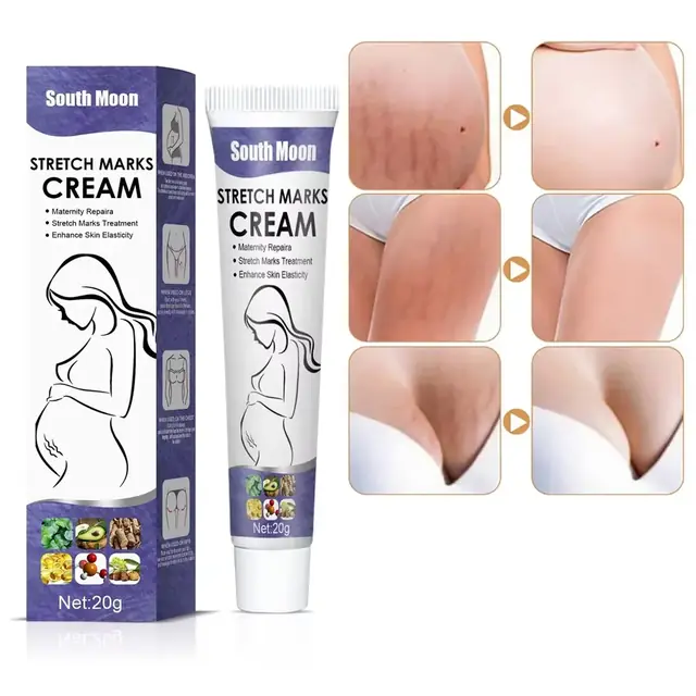 Stretch Marks Remover Cream - Image 5