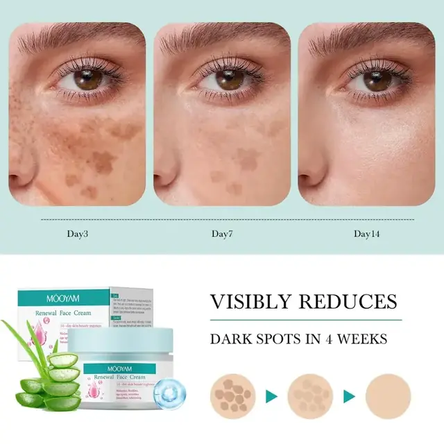 Renewal Face Cream Moisturizer for Brightening & Dark Spot Care - Image 5