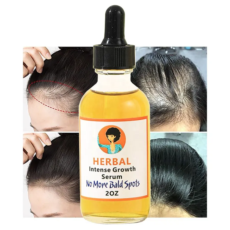 Hair Growth Serum - Image 2